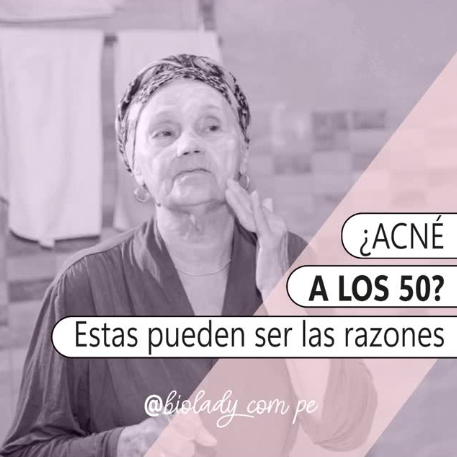 Acné a los 50